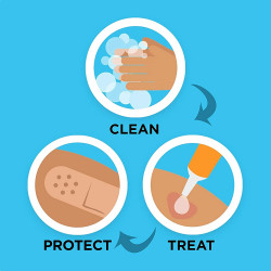 Band-Aid Brand Cushion Care Non-Stick Gauze Pads, Individually-Wrapped, Medium, 3 in x 3 in, 10 ct