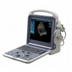 High Resolution Imaging System Smart Color Ultrasound Scanner Mslcu62 Portable Color Doppler Ultrasound Machine Price