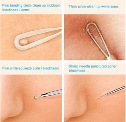 7PCS Pimple Blackhead Remover Kit